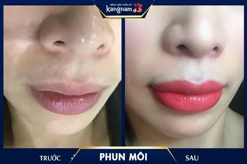 cách chữa khô môi