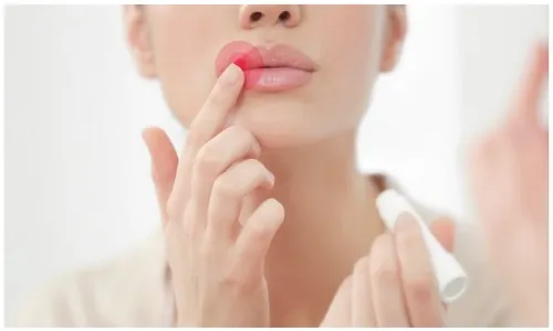 Môi sưng do cơ địa khách hàng