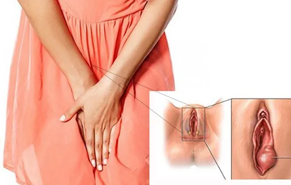 môi bé phì đại do bẩm sinh