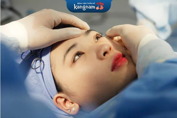 Phẫu thuật thẩm mỹ mắt cải thiện mắt sụp mí hiệu quả