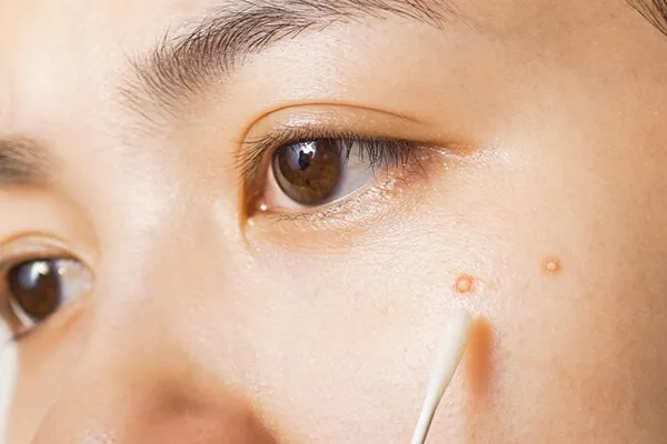 sát trùng sát trùng