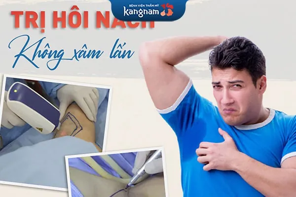trị hôi nách tại kangnam