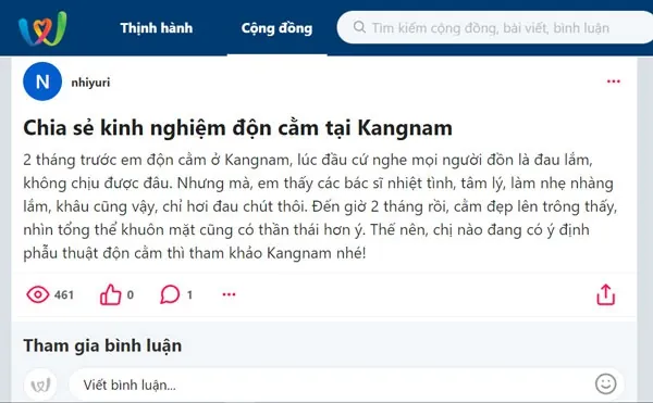 Khách hàng chia sẻ kinh nghiệm độn cằm tại kangnam
