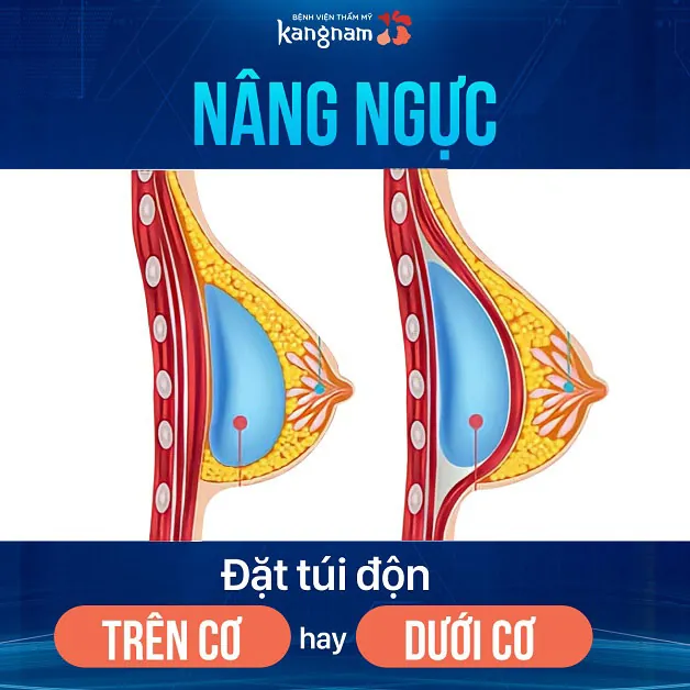 Độ bền tốt