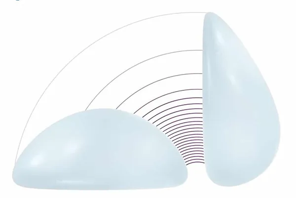 được gắn chíp