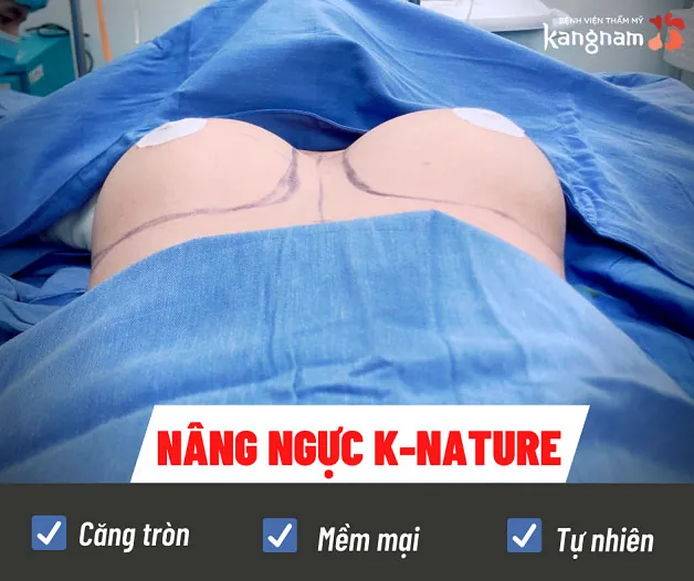 Nâng ngực K-Nature