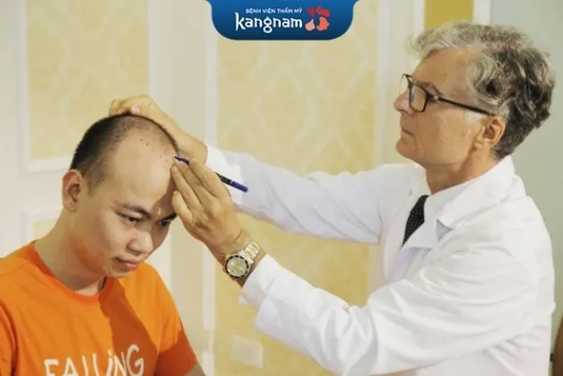 Bác sĩ phác thảo đường cấy tóc