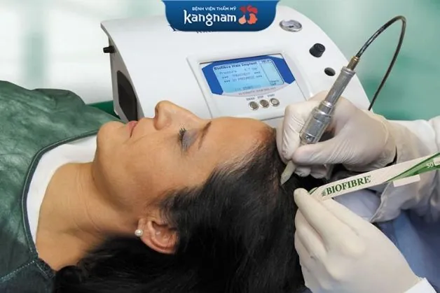 Cấy tóc sinh học an toàn cho da đầu