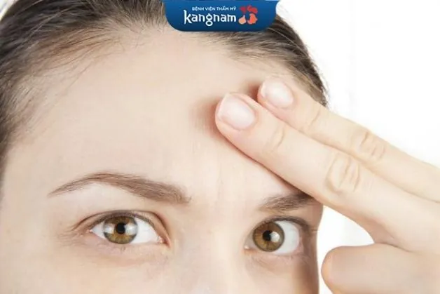 Có nên cấy tóc cho trán cao