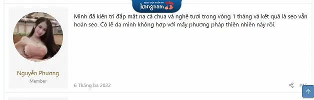 Bạn Phương chia sẻ trên diễn đàn làm đẹp