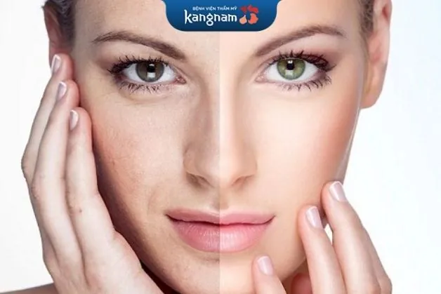 Trẻ hóa da bằng laser là một phương pháp an toàn