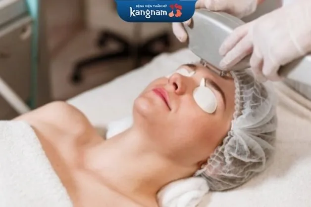 Triệt lông mặt an toàn tại Kangnam