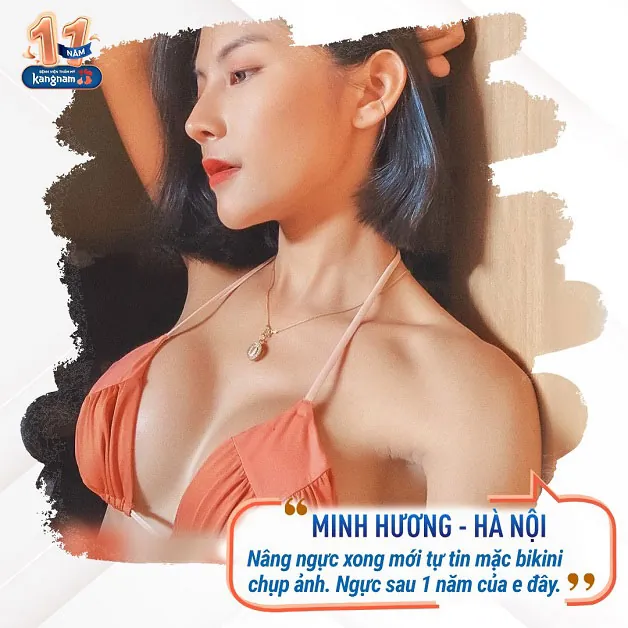 Nâng ngực mang lại sự tự tin 