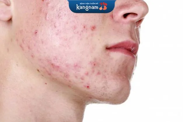 Da mặt dị ứng khá nguy hiểm