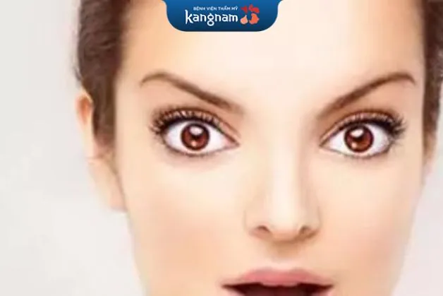 Mắt dê khiến tướng mày sao chổi có vận mệnh kém hơn