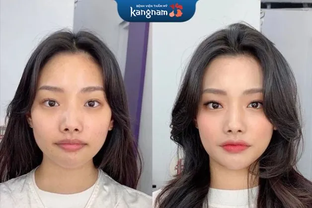 Khắc phục mũi tẹt, ngắn hiệu quả nhờ trang điểm