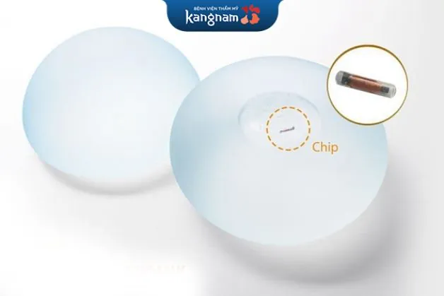 Mô cấy gắn chip vô cùng tiện lợi
