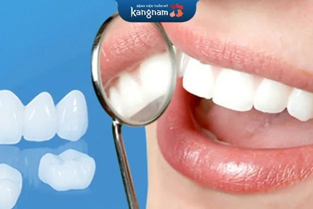 Trung bình răng sứ titan có thể duy trì từ 5 - 8 năm