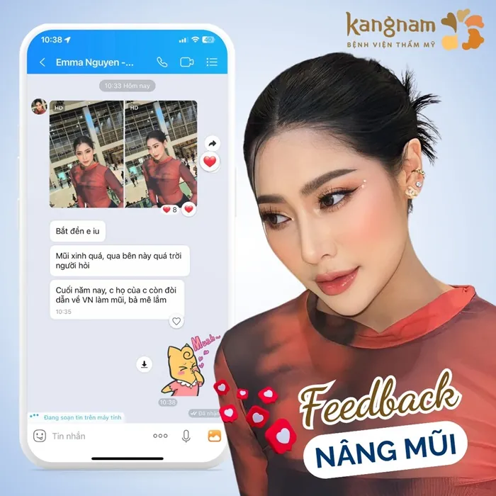 Lột xác nhờ nâng mũi cao