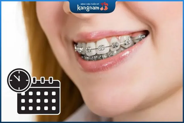 Có giảm thời gian niềng răng được không?