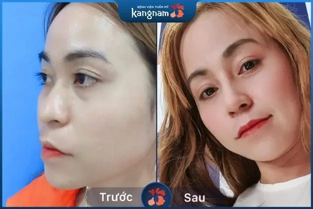 Phương Đông xinh đẹp hơn hẳn