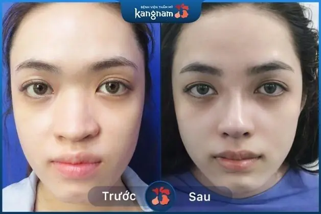 Khách hàng Cao Hồng Hảo nêu cảm nghĩ khi sử dụng dịch vụ tại Kangnam