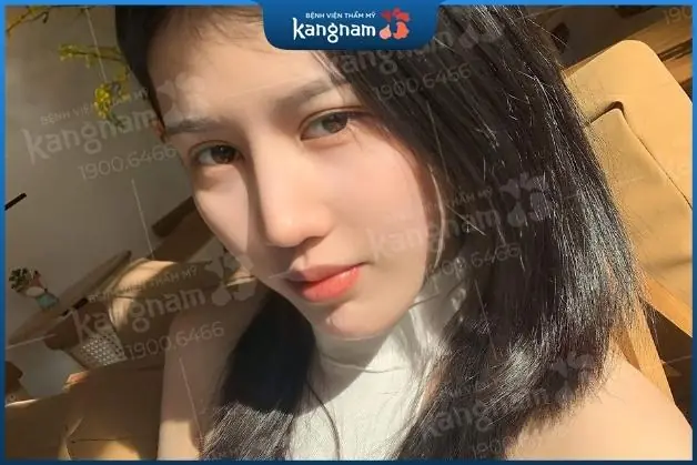 Chi phí nâng mui phù hợp