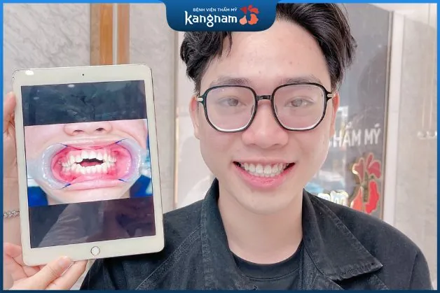 Hàm răng đều đẹp và cân đối sau khi niềng