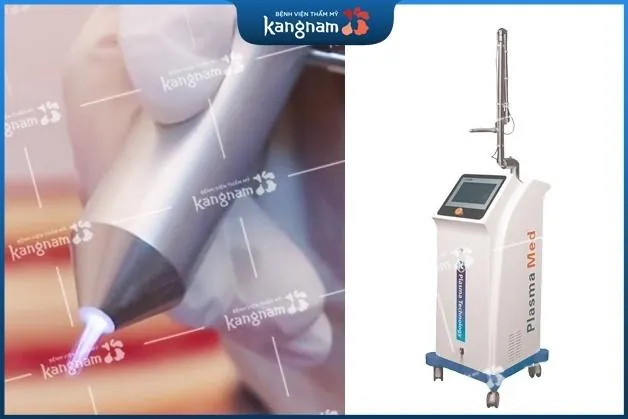 Máy chiếu tia Plasma khi Thu mỏng môi 6D