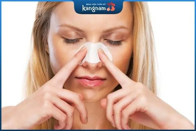 Chăm sóc mũi cẩn thận sau khi cắt cánh mũi hếch