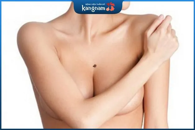 Nốt ruồi ở giữa ngực phụ nữ