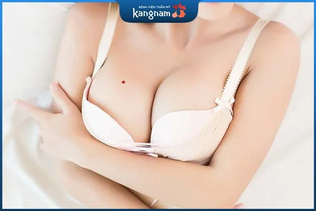 Nốt ruồi son ở ngực phải