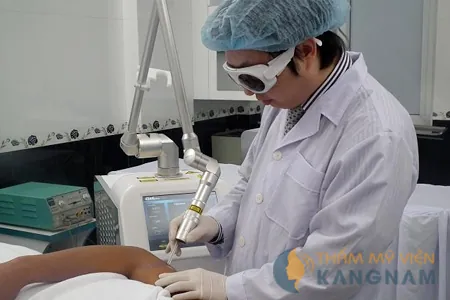 xoa xam vung kin bang laser toning