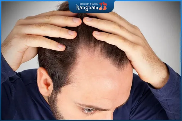 Trán chữ M là người độc lập, sống hướng nội