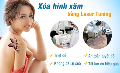cách xóa xăm triệt để, an toàn và hiệu quả nhất hiện nay dia-chi-tin-cay-xoa-xam-vinh-vien-2