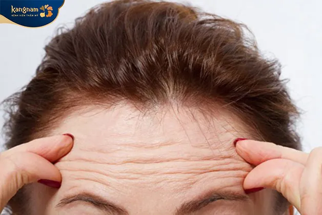 Tuổi tác là một trong những nguyên nhân gây hình thành nhăn ở trán