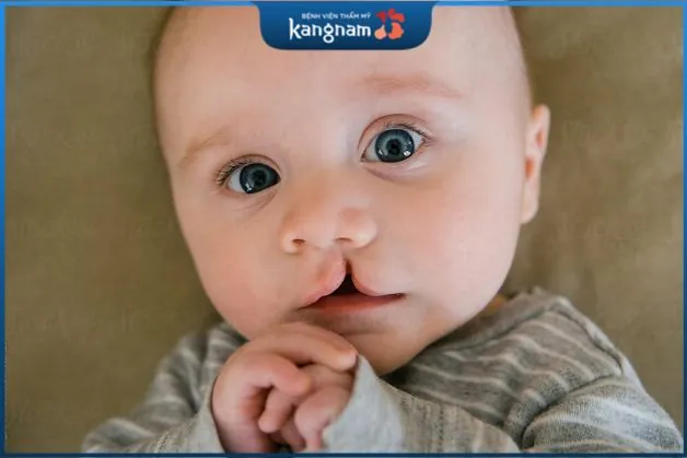 Hở hàm ếch có chữa được không