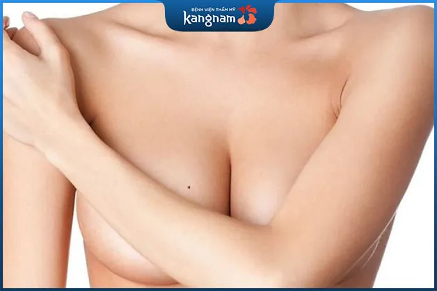 Nốt ruồi trên bầu ngực