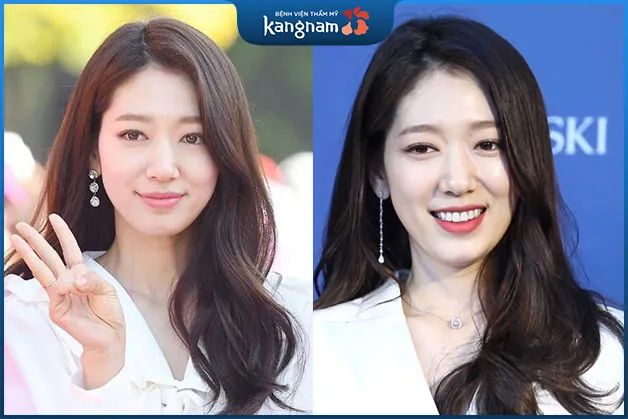 Trán bán nguyệt là người sống tình cảm, thủy chung son sắt