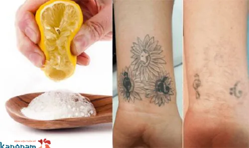 xóa xăm tại nhà