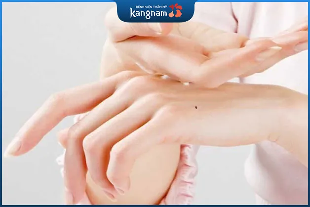 Nốt ruồi phú quý đem lại nhiều điều tốt đẹp cho vận mệnh