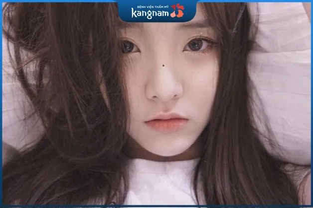 nốt ruồi xui xẻo