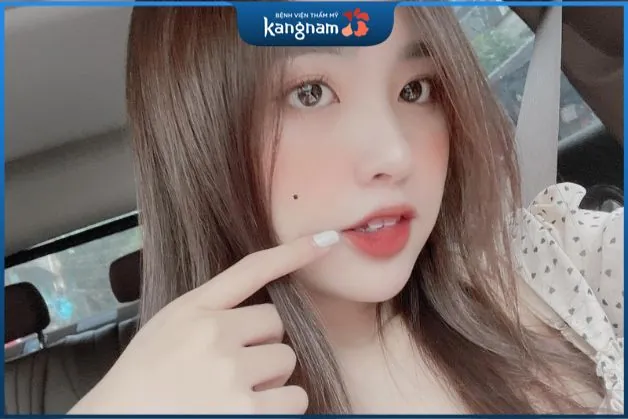 Nốt ruồi xuất hiện trên má nữ giới cũng là một trong những đặc điểm mang đến điềm xui xẻo