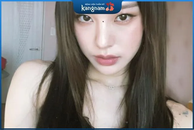 nếu có nốt ruồi ở sơn căn là điềm báo đời sống vợ chồng nhiều xung đột