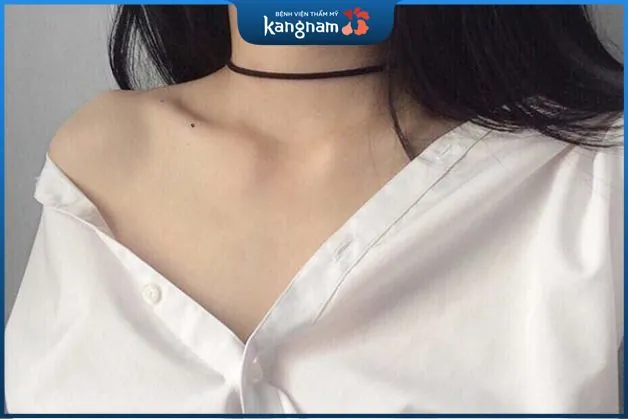 Nốt ruồi ở xương quai xanh thường là điềm xui xẻo