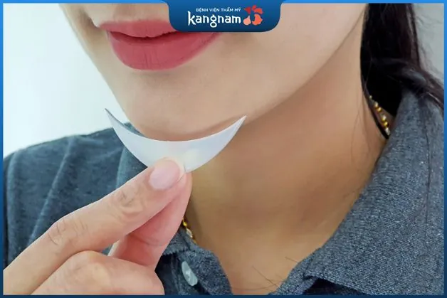 Độn cằm silicon được bao lâu?