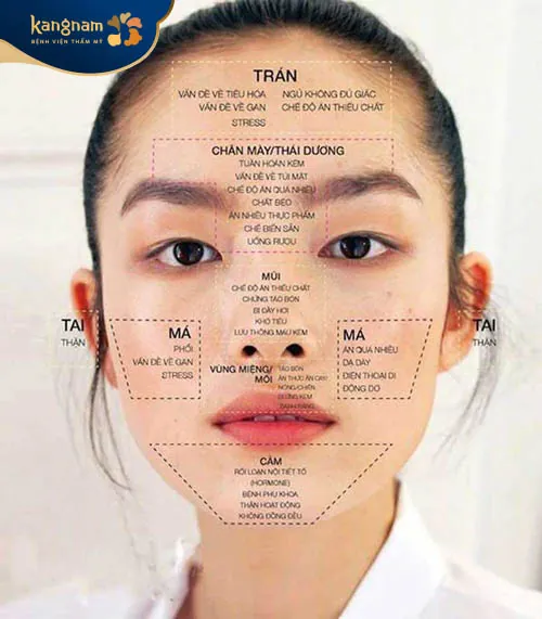 Các vị trí bị mụn trên khuôn mặt