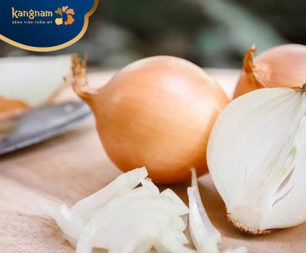 Hành tây giúp kháng nấm và chống viêm hiệu quả