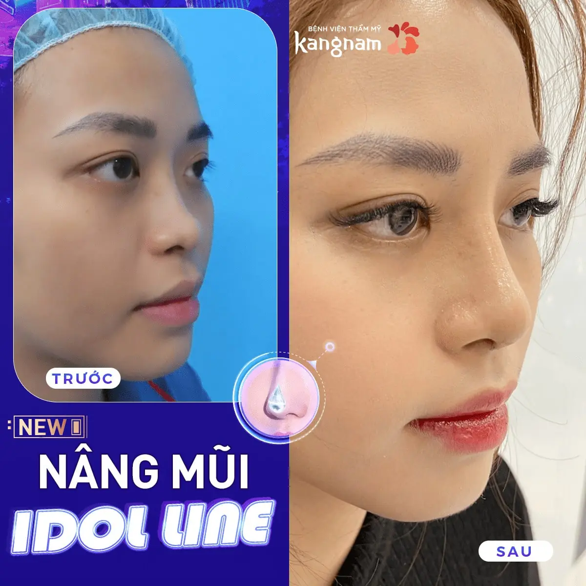 Mũi cao bay nhẹ nhàng, đầu mũi kín chuẩn Hàn