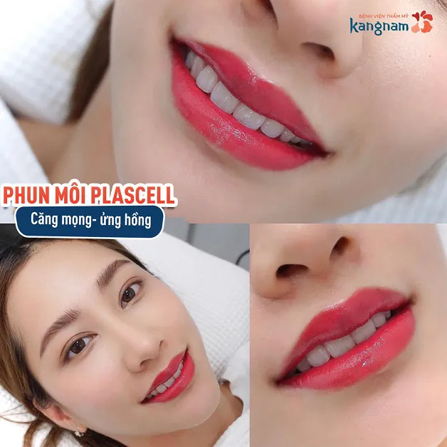 Ưu tiên những spa đã có danh tiếng trên thị trường